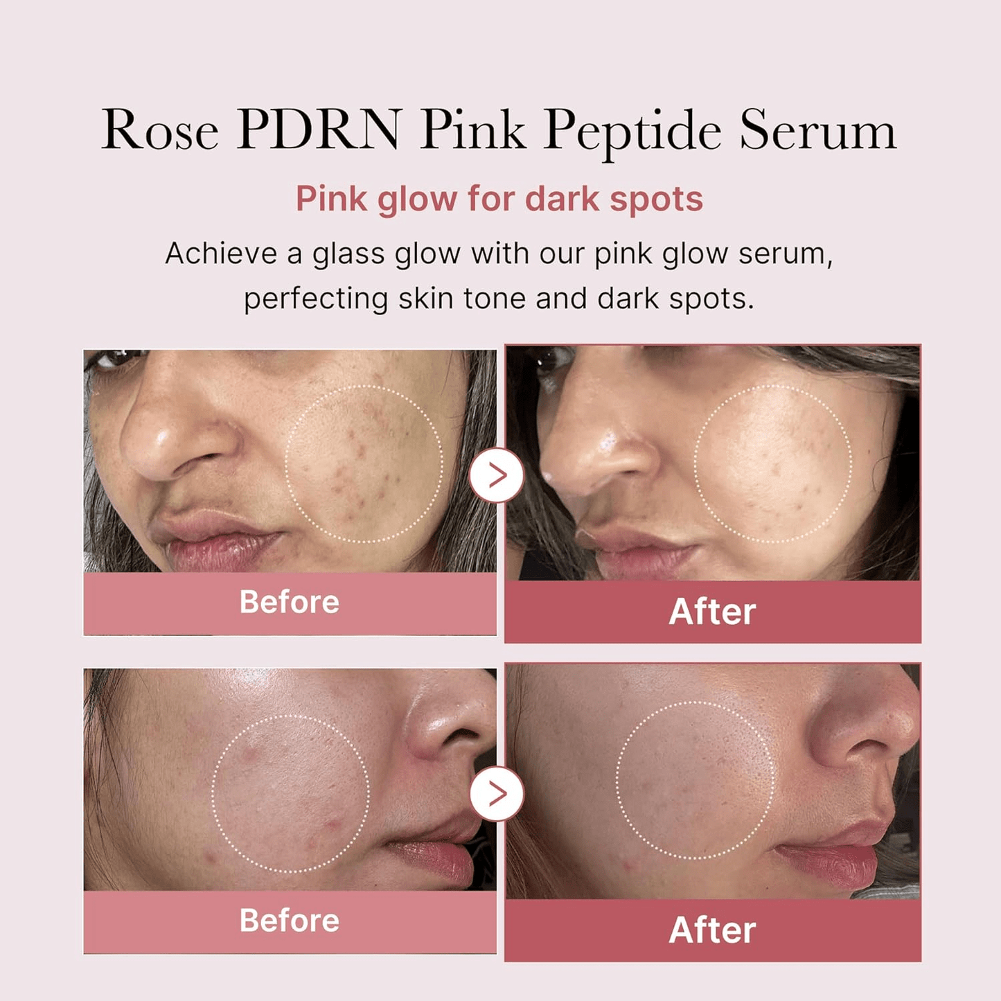 MEDICUBE
Collagen PDRN Pink Peptide Serum (30ml)